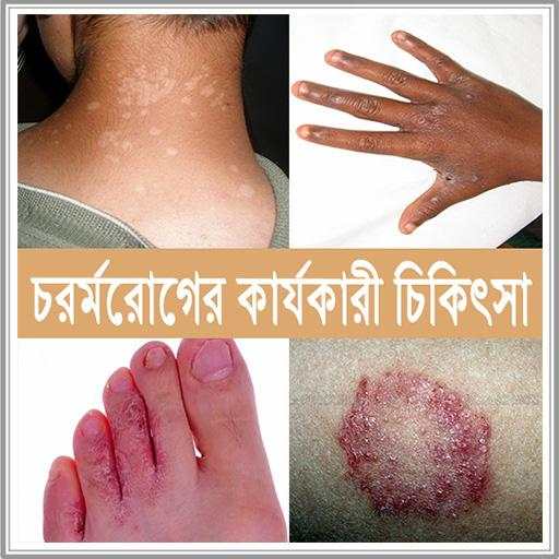 চর্ম রোগের কারণ  ও  কার্যকারী চিকিৎসা [ ছবি সহ ] 3.2