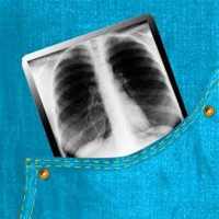 Easy Chest X-Ray иконка