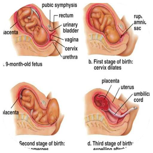 labor and delivery 1.1