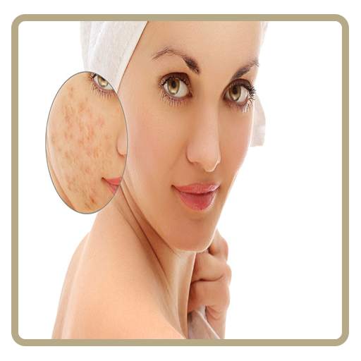 Acne & Pimples (Home Care) 2.5