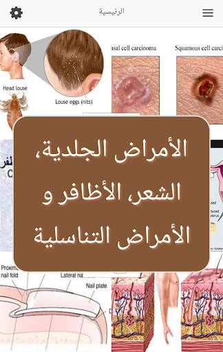 الأمراض الجلدية و التناسلية screenshot 1