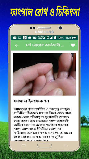 চর্ম রোগের কারণ  ও  কার্যকারী চিকিৎসা [ ছবি সহ ] screenshot 3