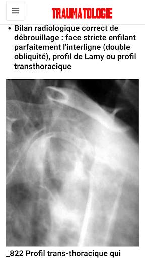 Traumatologie скриншот 7
