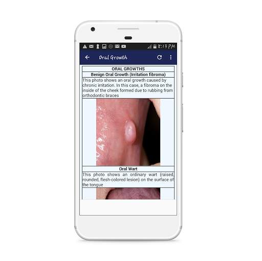 All Dental Disorders screenshot 5