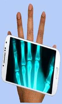 Xray Scanner screenshot 4