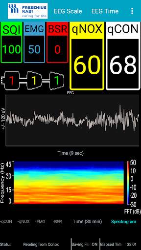 Conox View screenshot 7
