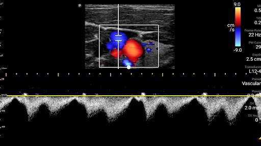 Philips Lumify Ultrasound App screenshot 8