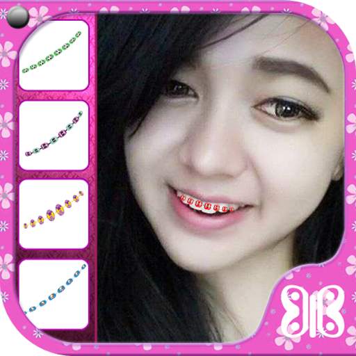 Beauty Brace Camera 1.4