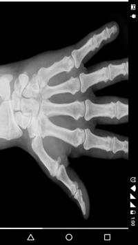 X - Ray Scanner Prank screenshot 7