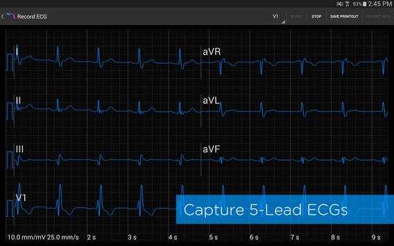 Alirus ECG screenshot 2