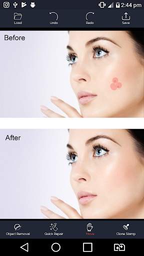 Photo Retouch - Blemish Remove screenshot 1