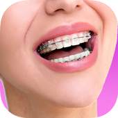 Top Design Braces teeth 1.0