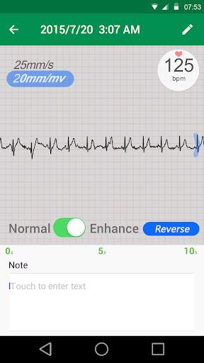 MiCor screenshot 1