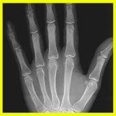 Xray icon