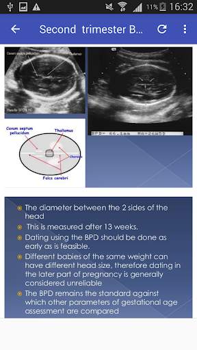 2nd & 3rd trimester OB/GY Ultrasound 2 تصوير الشاشة