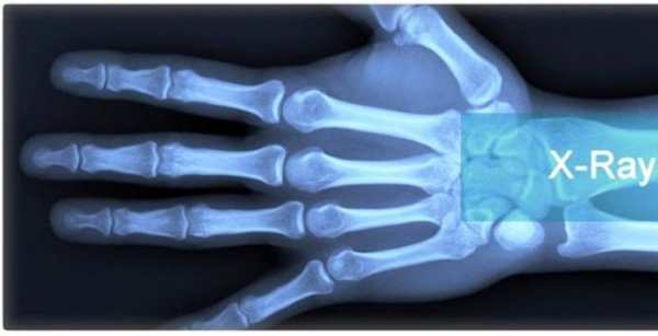 X-Ray Cloth Scanner Prank screenshot 5