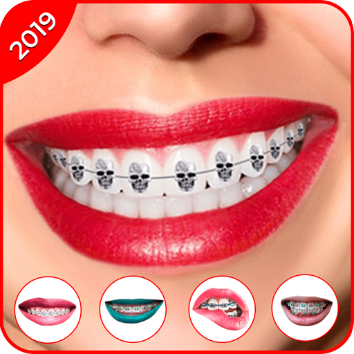 Braces 2019 - Braces Yourself Prank icon