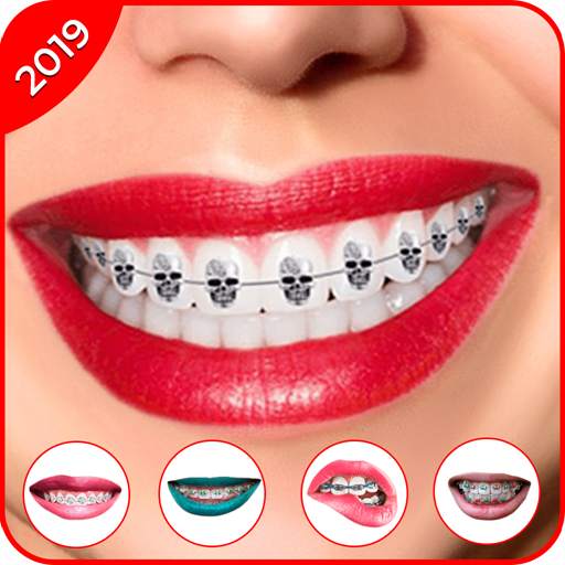 Braces 2019 - Braces Yourself Prank 1.2