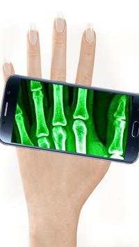 X-Ray Scanner screenshot 2