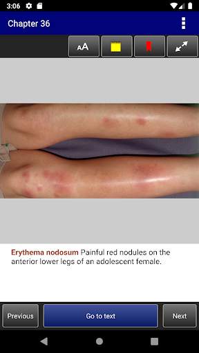 Pediatric Dermatology DDx Deck, 2nd Edition screenshot 6