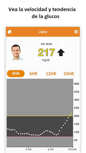 Dexcom Follow mg/dL DXCM3 screenshot 2