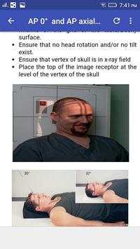 Skull Radiographic Positioning screenshot 7