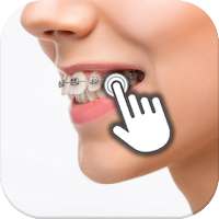 Braces on teeth FX: Photo editor