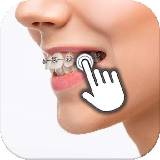 Braces on teeth FX: Photo editor 1.1