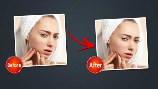Object Remover -Erase Object -Face Blemish Remover screenshot 6