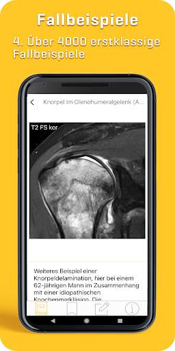 MRI Essentials screenshot 4