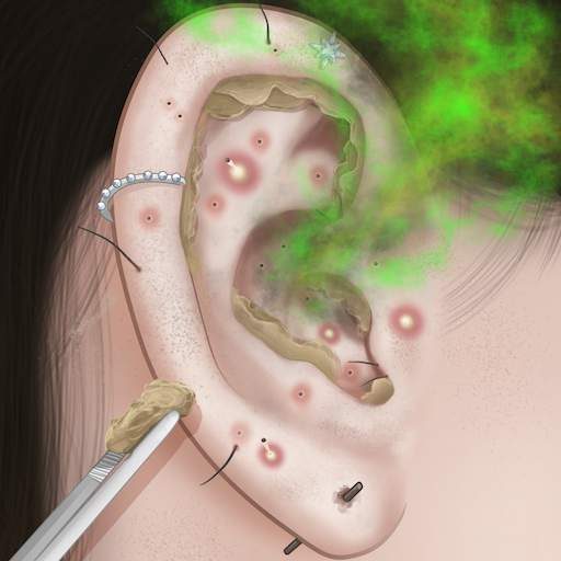 Ear Cleaning Master 1.0.1