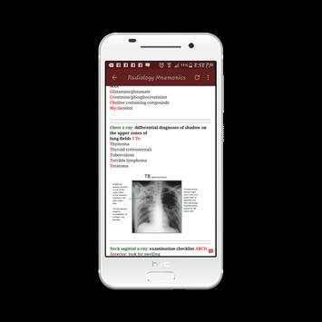 Radiology Mnemonics screenshot 3