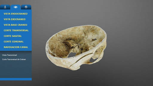 UC MedApp Craneo 3D screenshot 6