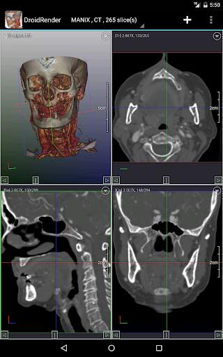 DroidRender - 3D DICOM viewer स्क्रीनशॉट 9