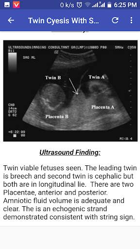 Ultrasound Guide A2Z screenshot 1
