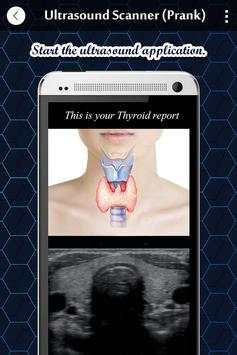 Ultrasound X-ray Scanner Prank screenshot 3