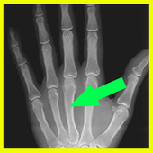 Xray icon