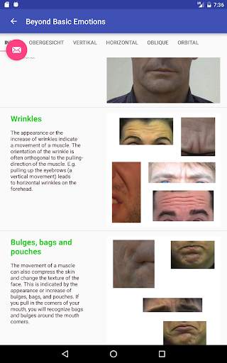 Facial expression - Prof. Dr. Joerg Merten screenshot 3