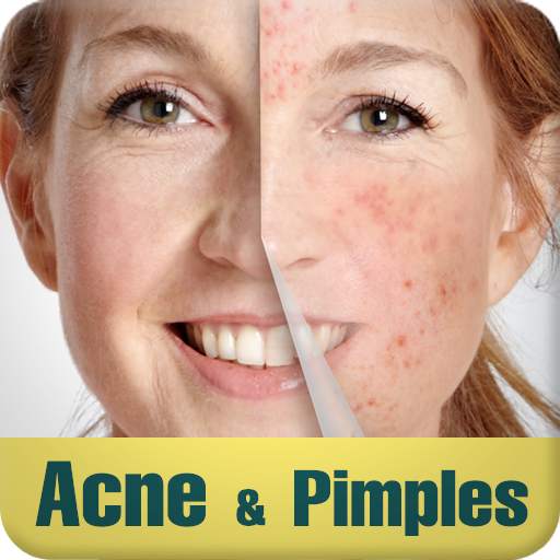 Acne & Pimples 1.0