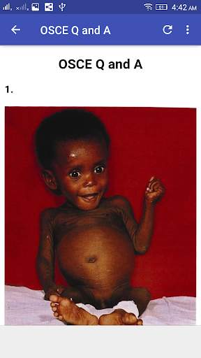 Pediatrics  OSCE Q and A screenshot 3
