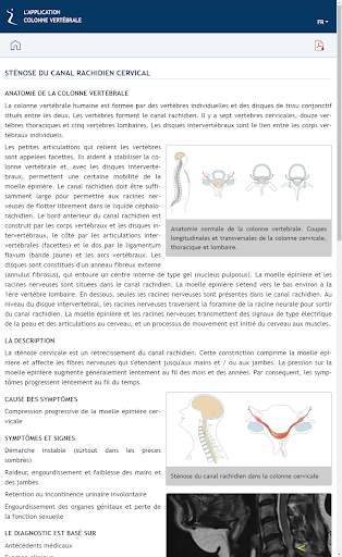 L'APPLICATION COLONNE VERTÉBRALE screenshot 3
