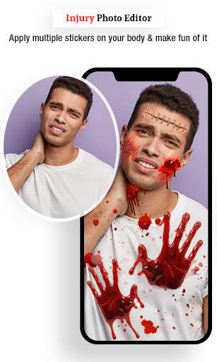 Injury Photo Editor screenshot 3