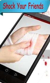 Injury Photo Maker-Fake Injury screenshot 4