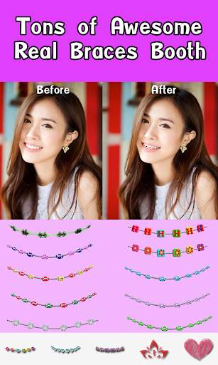 Braces Booth screenshot 2