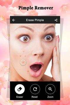 Pimple Remover : Beauty Plus screenshot 3
