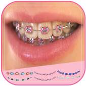 Braces Photo Booth 1.0