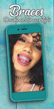 Braces screenshot 3