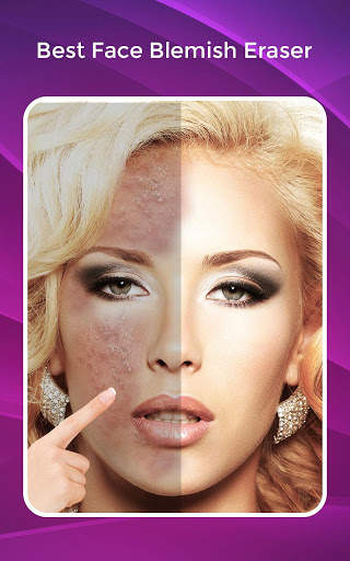 Face Blemish Eraser makeup screenshot 6