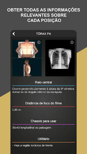 RX - Radiologia Posicionamento screenshot 4
