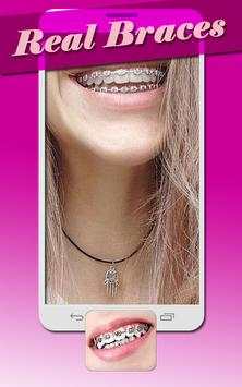 Real Braces Teeth Booth Pro screenshot 3